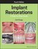 Implant Restorations : A Step-by-Step Guide