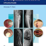 Management of Orthopaedic Infections: A Practical Guide 1st Edición