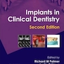 Implants in Clinical Dentistry 2nd Edición
