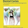 Dental Caries: The Disease and its Clinical Management 3rd Edición