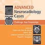 Advanced Neuroradiology Cases: Challenge Your Knowledge 1st Edición