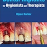 Dental Implants for Hygienists and Therapists 1st Edición