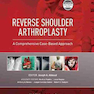 Reverse Shoulder Arthroplasty : A Comprehensive Case-Based Approach