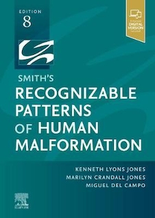 Smith's Recognizable Patterns of Human Malformation2021