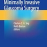 Minimally Invasive Glaucoma Surgery 1st ed