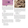 Robbins and Cotran Review of Pathology (Robbins Pathology) 5th Edicion 2022