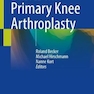Basics in Primary Knee Arthroplasty