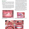 Contemporary Fixed Prosthodontics 6th Edition2023