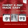 Chest X-Ray Made Easy 5th Edition