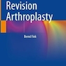 Femoral Revision Arthroplasty