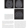 Merritt’s Neurology Fourteenth Edition