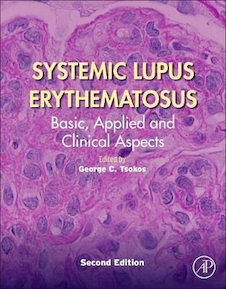 عکس Systemic Lupus Erythematosus : Basic, Applied and Clinical Aspects