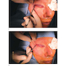 Facial Paralysis A Comprehensive Rehabilitative Approach