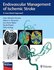 Endovascular Management of Ischemic Stroke : A Case-Based Approach