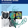 Endovascular Management of Ischemic Stroke : A Case-Based Approach