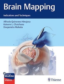 عکس Brain Mapping Indications and Techniques