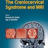 The Craniocervical Syndrome and MRI