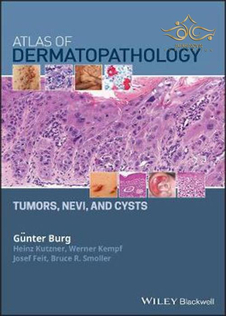   Atlas of Dermatopathology: Tumors, Nevi, and Cysts 1st Edition, Kindle Edition 2019 اطلس پوست : تومورها ، نووی و کیست 