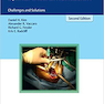 2018 Spinal Instrumentation: Challenges and Solutions 2nd Edition, Kindle Edition ابزار ستون فقرات: چالش ها و راه حل ها