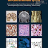 Classification of Tumours of the Central Nervous System, 4th Edition2016 WHO طبقه بندی تومورهای سیستم عصبی مرکزی