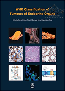 عکس WHO Classification of Tumours of Endocrine Organs, 4th Edition2017