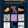 WHO Classification of Tumours of Endocrine Organs, 4th Edition2017 طبقه بندی تومورهای اندام های غدد درون ریز