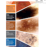 Dermatoscopy and Skin Cancer : A handbook for hunters of skin cancer and melanoma 2019 درماتوسکوپی و سرطان پوست: کتاب راهنما سرطان پوست