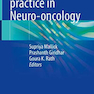 Evidence based practice in Neuro-oncology