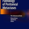 Pathology of Peritoneal Metastases : The Unchartered Fields2020آسیب شناسی متاستازهای صفاقی: زمینه های ناشناخته