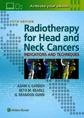 عکس Radiotherapy for Head and Neck Cancers : Indications and Techniques2017