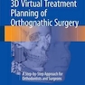 3D Virtual Treatment Planning of Orthognathic Surgery : A Step-by-Step Approach for Orthodontists and Surgeons