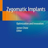 Zygomatic Implants : Optimization and Innovation
