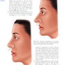 Textbook of Nasal Tip Rhinoplasty : Open Surgical Techniques