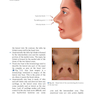 Textbook of Nasal Tip Rhinoplasty : Open Surgical Techniques