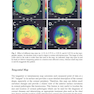 Diagnostics in Ocular Imaging: Cornea, Retina, Glaucoma and Orbit