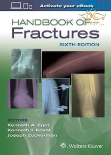 Handbook of Fractures Sixth Edition