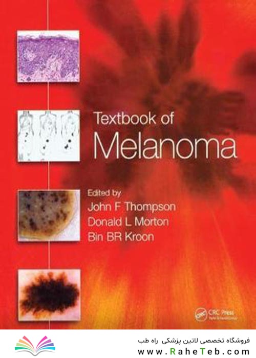 Textbook of Melanoma : Pathology, Diagnosis and Management2020کتاب درسی ملانوم: آسیب شناسی ، تشخیص و مدیریت