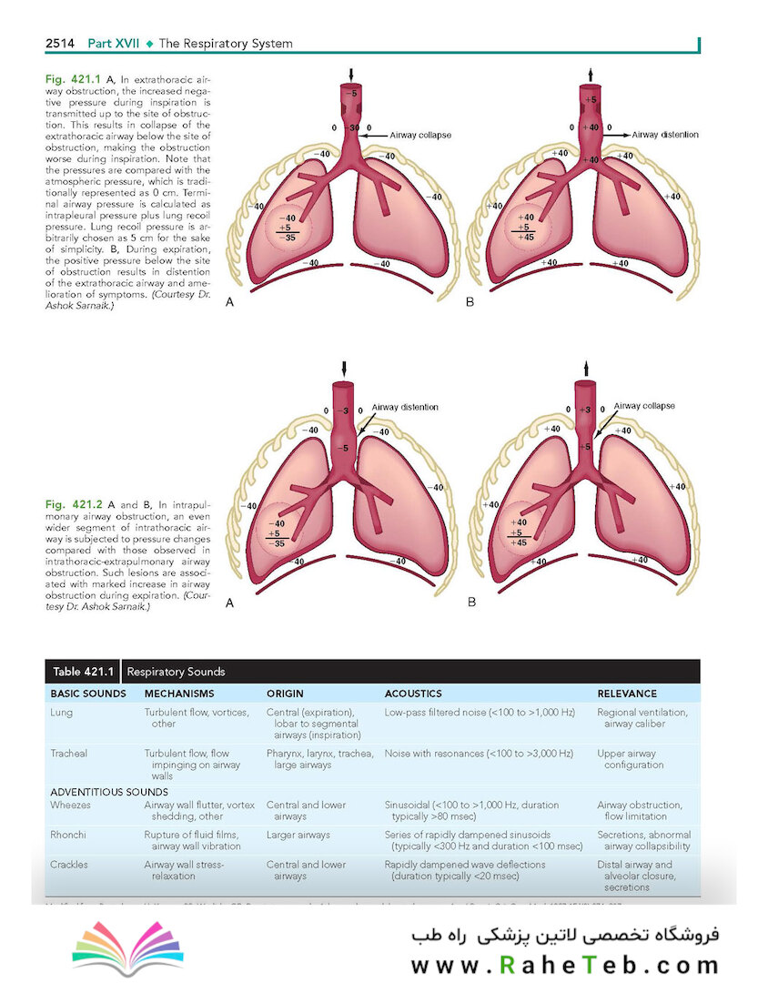 Nelson Textbook of Pediatrics, The Respiratory System ,22nd Edition