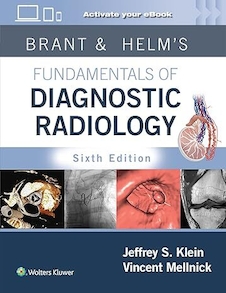 Brant & Helms' Fundamentals of Diagnostic Radiology:  Sixth Edition